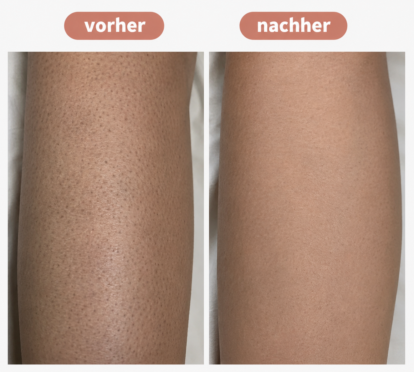 Vorher · Nachher